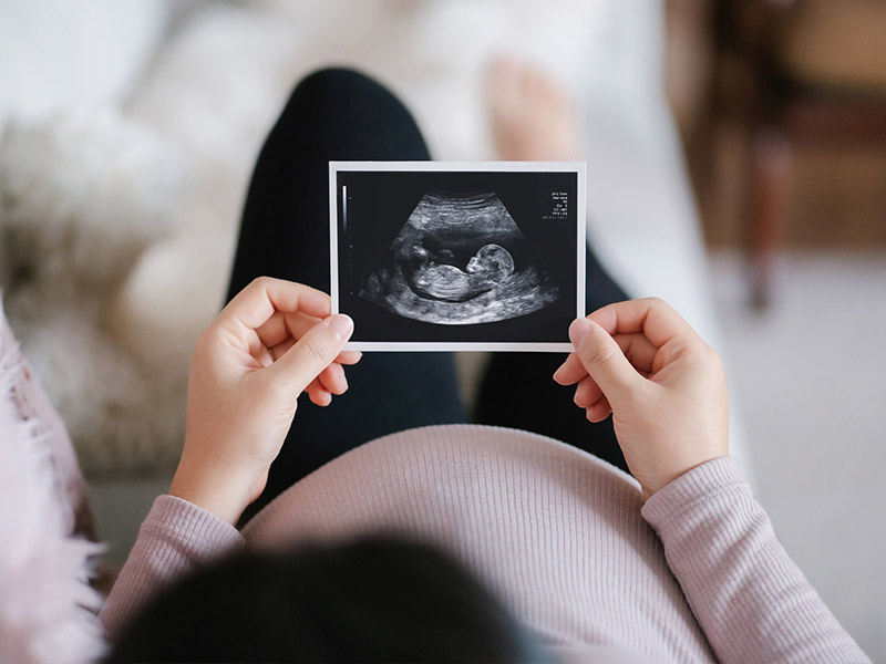 Pregnant woman looking at ultrasound photo